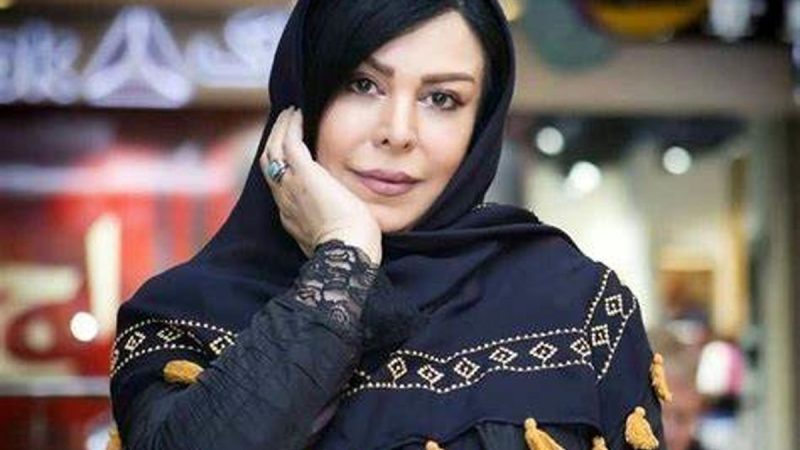 یک بیفور اَفتر باورنکردنی و دیده نشده از فلور نظری/ چه تغییری کرده! نمیشه اصلا شناختش!