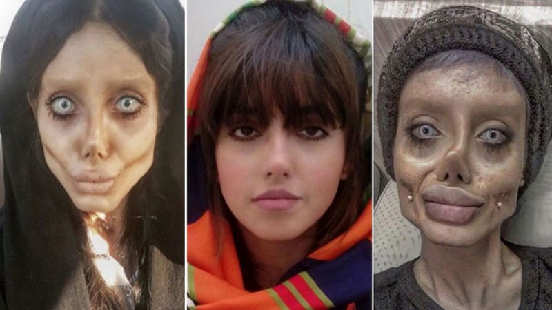 بیوگرافی و زندگی شخصی سحر تبر + عکس های قبل از عمل