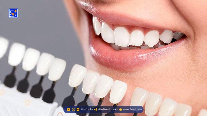 ویتامین‌های معجزه‌گر برای داشتن دندان‌هایی سفید و سالم