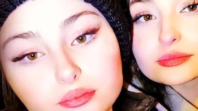 فیلم اولین عمل زیبایی سارا و نیکای پایتخت/ دوقلوهای پایتخت هم چهره شان رو دستکاری کردند …