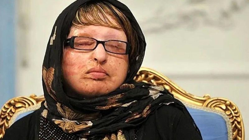 روایت ترسناک آمنه بهرامی از لحظه روبه‌رو شدن با خواستگار اسیدپاش ؛ از ترس به خودم لرزیدم