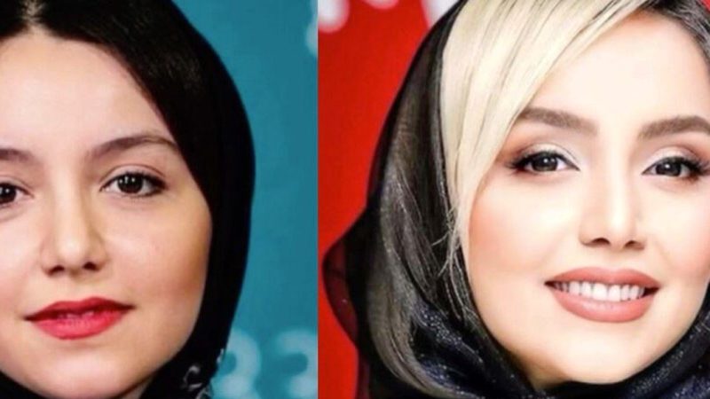 چهره نازنین بیاتی «مریم سریال تاسیان» از گذشته تا امروز، چه جراحی‌هایی انجام داده؟