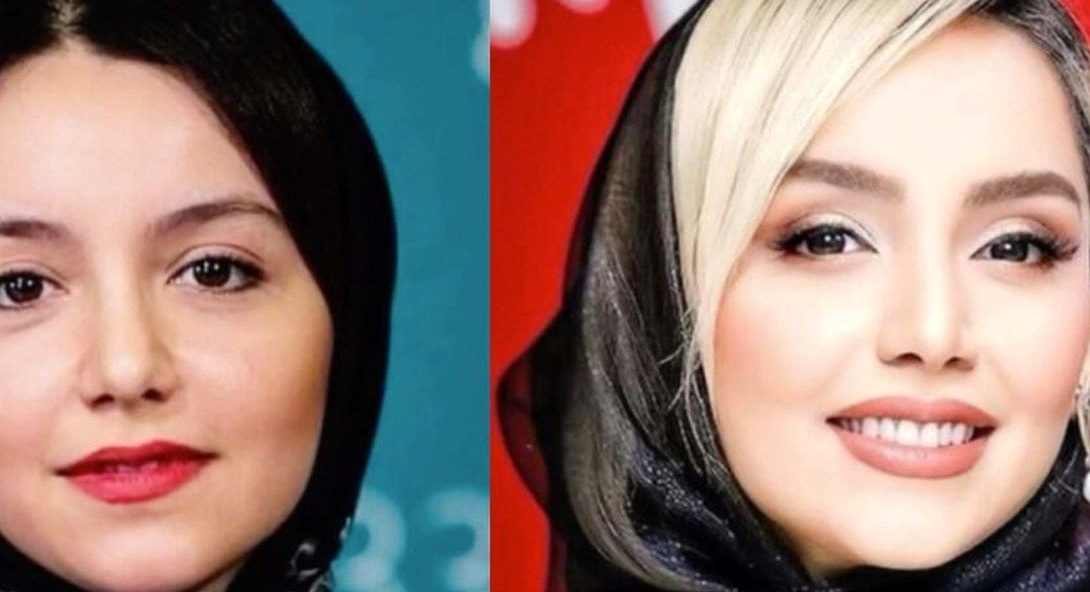 چهره نازنین بیاتی «مریم سریال تاسیان» از گذشته تا امروز، چه جراحی‌هایی انجام داده؟