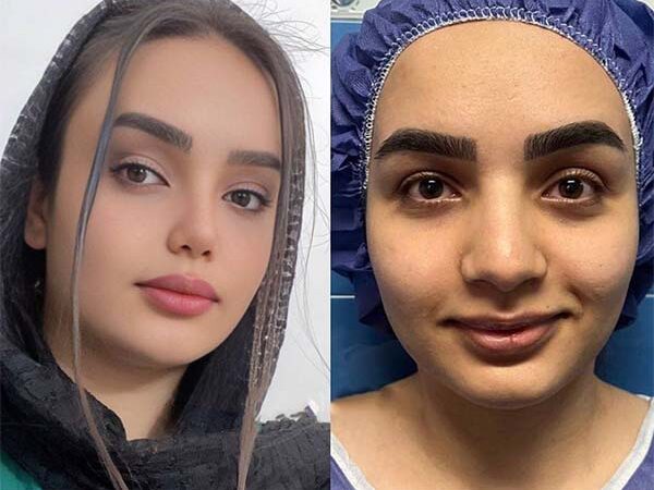 کشف راز بهترین جراحان بینی نیمه فانتزی؛ لیست ۱۰ نفر برتر که باید بشناسید!