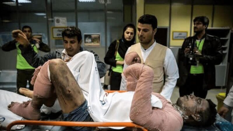 چرا ایرانی‌ها ۸ برابر بیشتر از جهان درگیر سوختگی می‌شوند؟