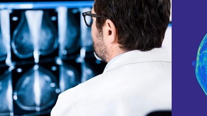 افزایش نگران‌کننده ۴ تا ۶ درصدی سرطان پستان در ایران؛ آیا ماموگرافی سالانه راه نجات است؟