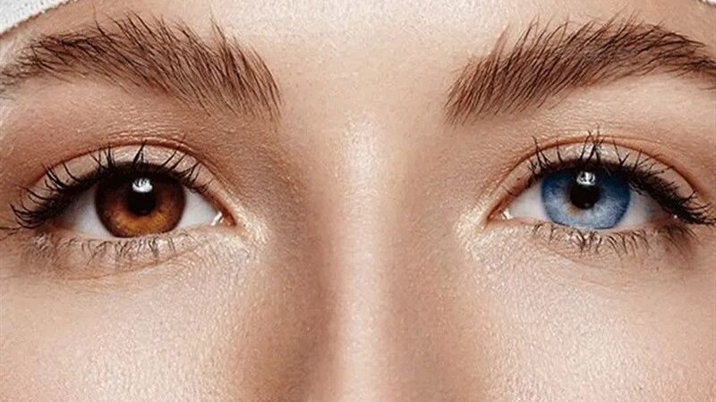 هشدار؛ تبلیغ جراحی تغییر رنگ چشم در خارج کشور تخلفی جدی است!