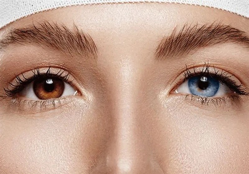 هشدار؛ تبلیغ جراحی تغییر رنگ چشم در خارج کشور تخلفی جدی است!