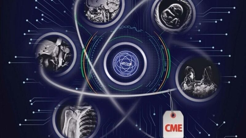 همراه اول با سمیناری ویژه، هوش مصنوعی را به قلب رادیولوژی ایران آورد!