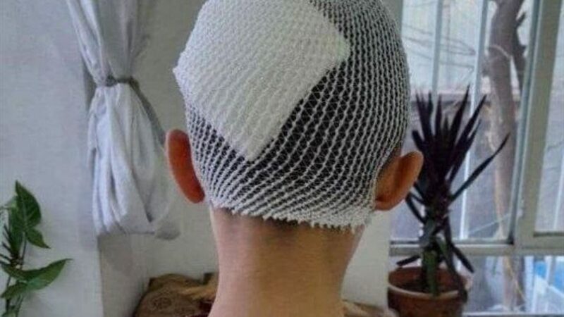 وقتی کلاس درس به میدان خشونت بدل شد؛ پرتاب لیوانی که سر دانش‌آموز را شکست!