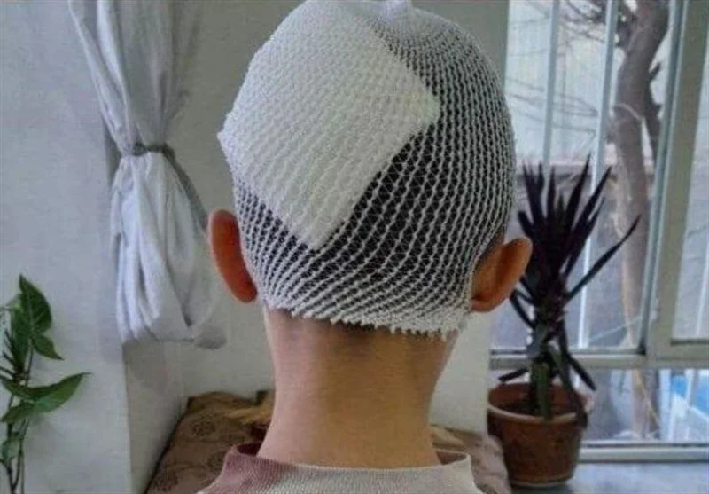 وقتی کلاس درس به میدان خشونت بدل شد؛ پرتاب لیوانی که سر دانش‌آموز را شکست!