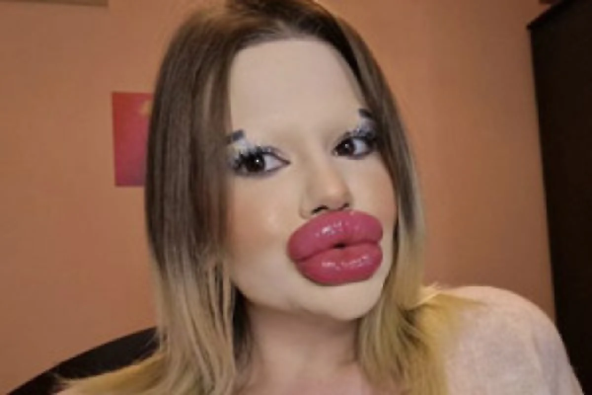 زنی با بزرگ‌ترین لب‌ها و استخوان گونه جهان که همه را شگفت‌زده کرد!