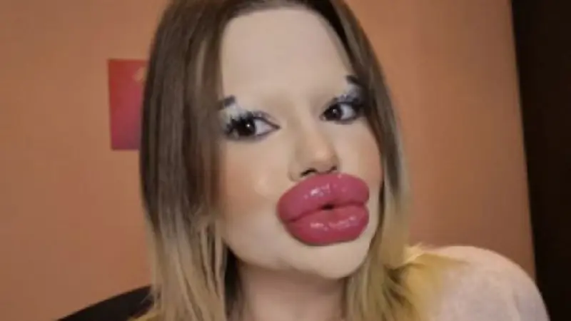 زن جوانی با بزرگ‌ترین لب‌ها و استخوان گونه‌های جهان که همه را حیرت‌زده کرد!