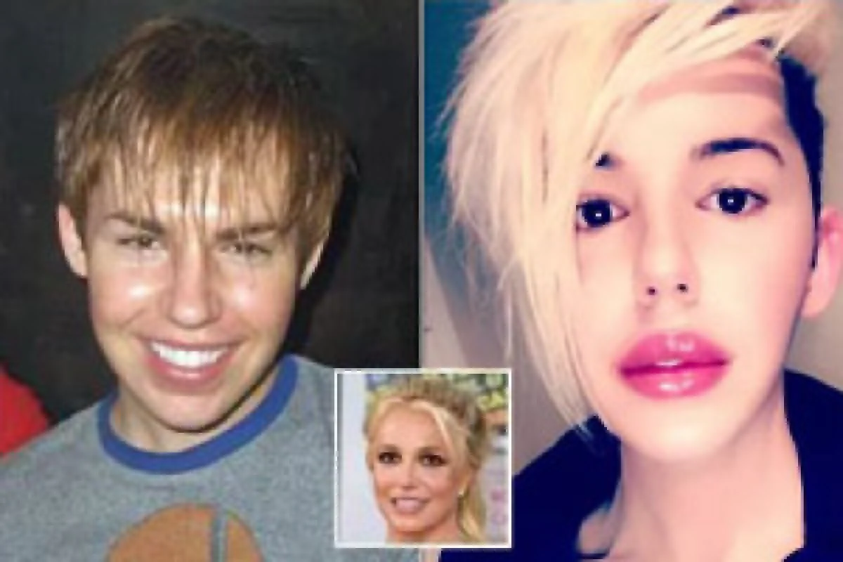 پسر جوان با 100 عمل زیبایی، بریتنی اسپیرز واقعی را خلق کرد!