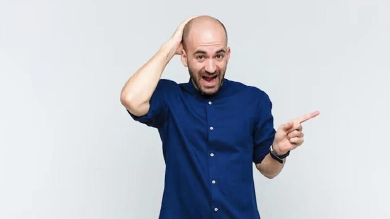 راز طاسی زودرس در نسل Z و میلی‌نیال‌ها؛ چرا موهای جوانان این‌قدر سریع نازک می‌شود؟