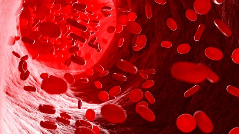 هشدار فوق تخصص خون: چرا تشخیص علت فقر آهن را نباید به تاخیر انداخت؟