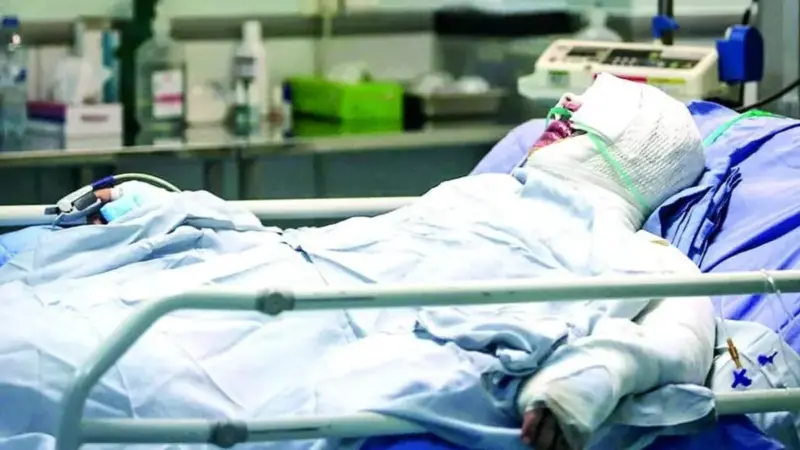 آمار نگران‌کننده سوختگی در ایران؛ ۸ برابر میانگین جهانی و هزاران قربانی سالانه