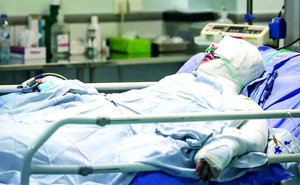 آمار نگران‌کننده سوختگی در ایران؛ ۸ برابر میانگین جهانی و هزاران قربانی سالانه