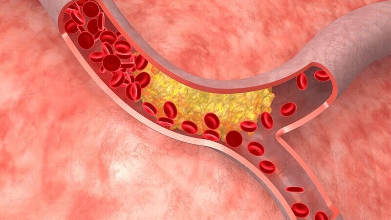 چای سبز؛ راز ساده و طبیعی کاهش چربی خون که همه باید بدانند!