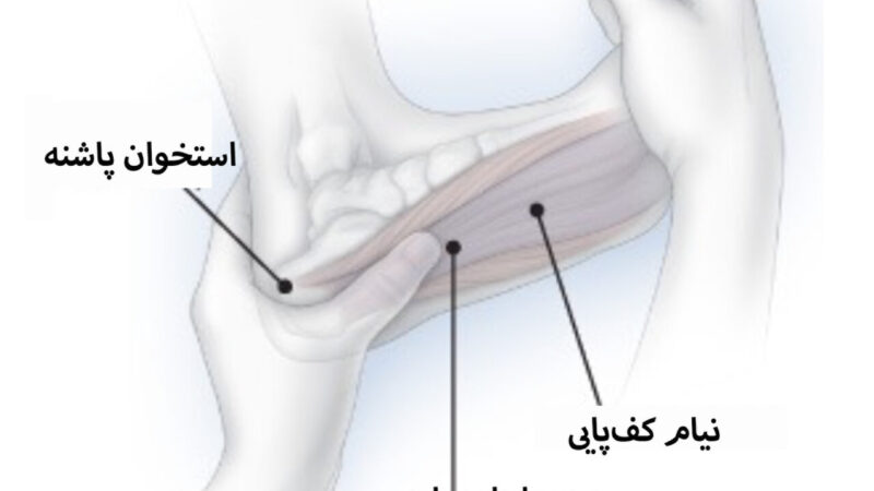 درد پاشنه پا را با این درمان‌های خانگی ساده و موثر تسکین دهید!