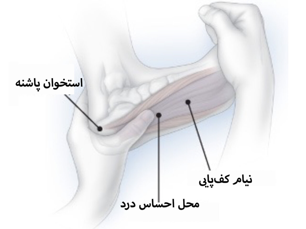 درد پاشنه پا را با این درمان‌های خانگی ساده و موثر تسکین دهید!