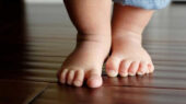 کف پای صاف در کودکان؛ کی باید نگران شد؟ توضیحاتی که والدین باید بدانند!