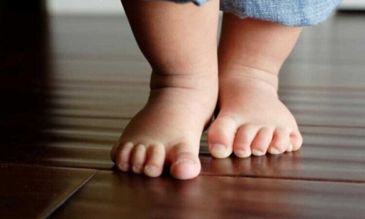 کف پای صاف در کودکان؛ کی باید نگران شد؟ توضیحاتی که والدین باید بدانند!