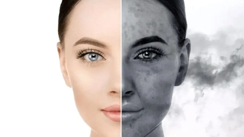 هشدار یک متخصص درباره افزایش خطر سرطان پوست در شهرهای آلوده؛ چگونه پوست خود را محافظت کنیم؟