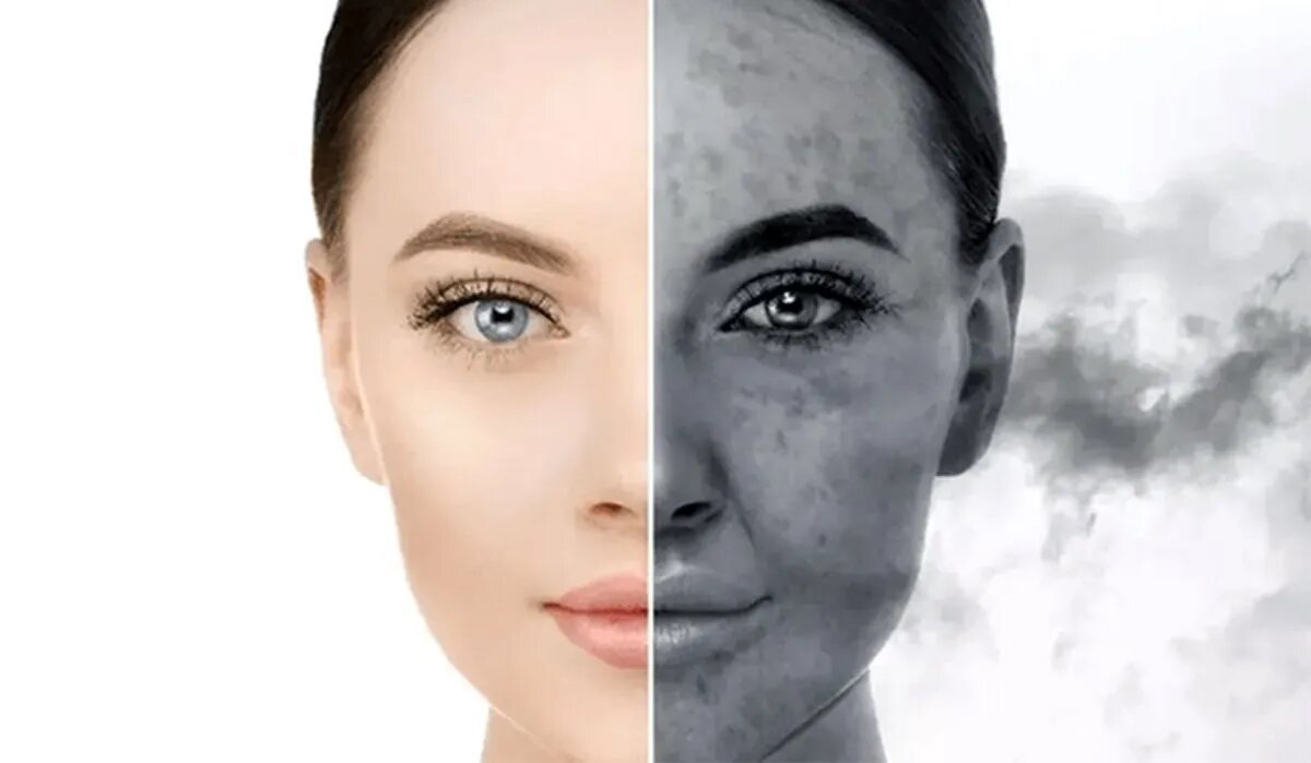 هشدار یک متخصص درباره افزایش خطر سرطان پوست در شهرهای آلوده؛ چگونه پوست خود را محافظت کنیم؟