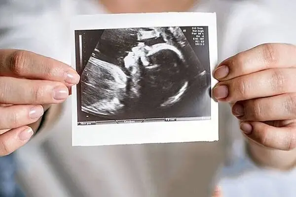 حمایت روانی؛ راز طلایی تداوم بارداری که همه باید بدانند!