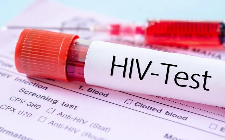 آیا شما هم در جمع افراد پرخطر برای آزمایش ایدز هستید؟ نکاتی که باید بدانید!