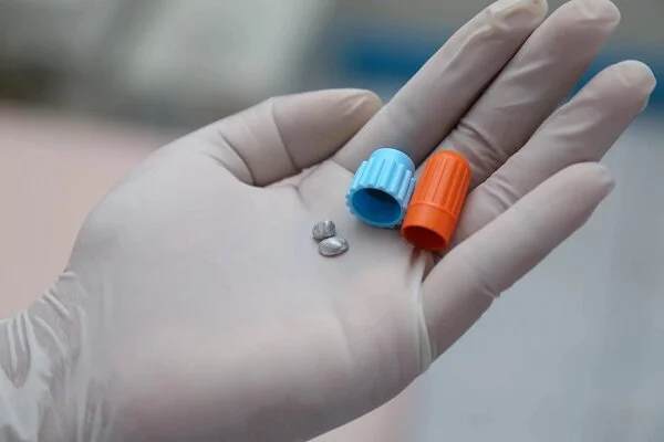 آمالگام در پرکردن دندان؛ مزایا و خطرات پنهان که باید بدانید!