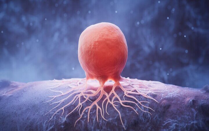 نانوذراتی که داروی ضدسرطان پستان را به هدف می‌رسانند؛ امیدی نوین در درمان سرطان