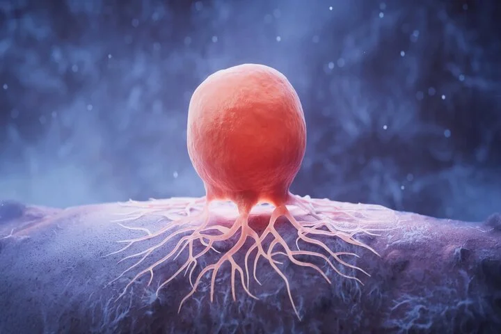 نانوذراتی که داروی ضدسرطان پستان را به هدف می‌رسانند؛ امیدی نوین در درمان سرطان