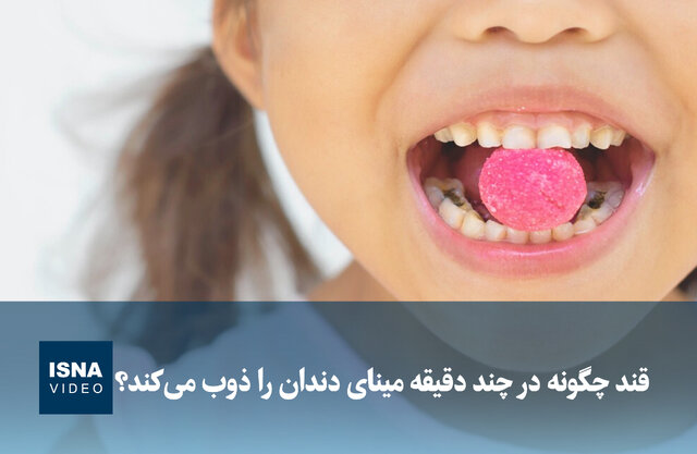 شگفتی قند در نابودی مینای دندان؛ تنها در چند دقیقه!
