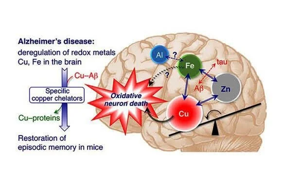 تشدید آلزایمر و نقش بازدارنده ترکیبات معطر گیاهی در مقابله با آن