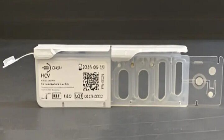 انقلاب در تشخیص هپاتیت C؛ نتیجه آزمایش فقط در ۱۵ دقیقه!