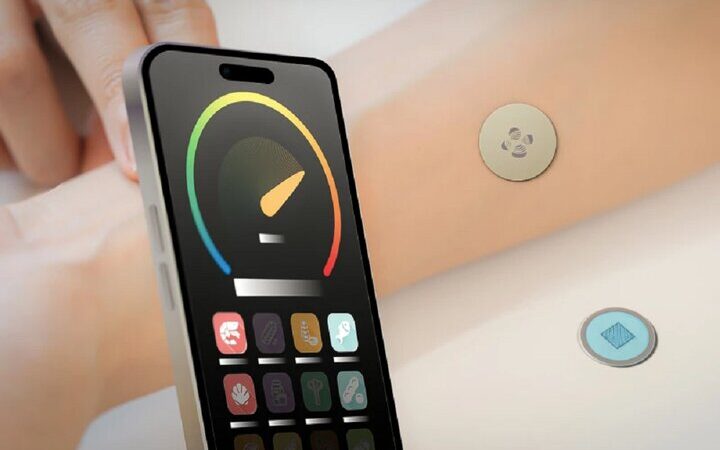 برچسبی که جان بیماران حساسیت شدید را نجات می‌دهد؛ آیا می‌دانید چگونه؟