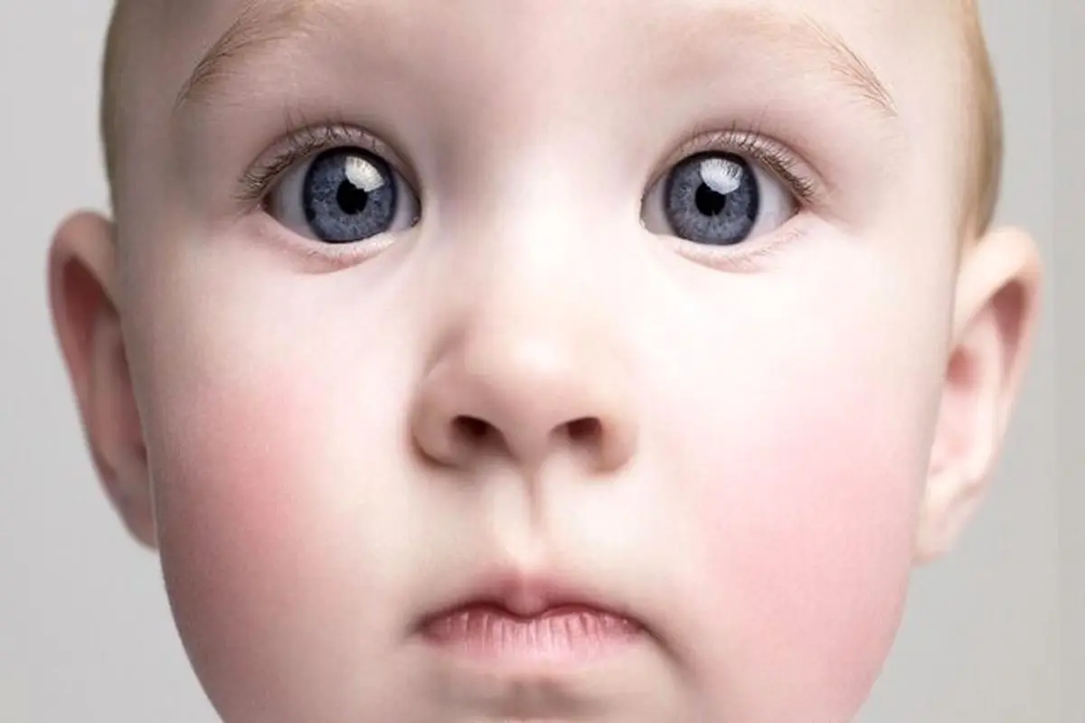 زوال عقل از کودکی آغاز می‌شود؛ آیا می‌توان جلوی آن را گرفت؟