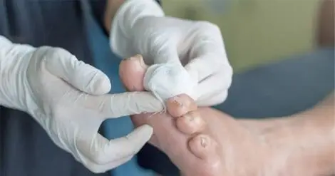 خدمتی نوین و رایگان برای بیماران دیابتی در کرج؛ پلاسما درمانی که زندگی را نجات می‌دهد!