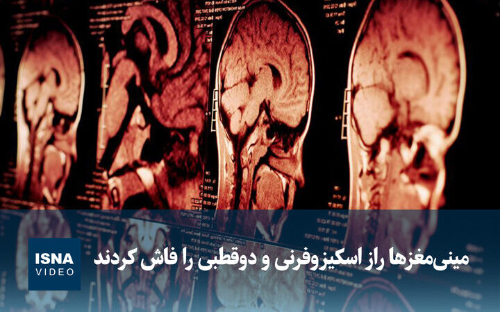 راز شگفت‌انگیز اسکیزوفرنی و دوقطبی در مینی‌مغزهای ساخته‌شده فاش شد!