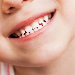 چرا دندان دائمی کودک بعد از افتادن دندان شیری دیر رویش می‌کند؟ زمان واقعی را بدانید!