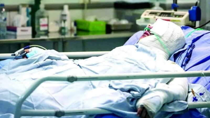 چرا ایرانی‌ها ۸ برابر بیشتر از جهان در معرض سوختگی وحشتناک هستند؟