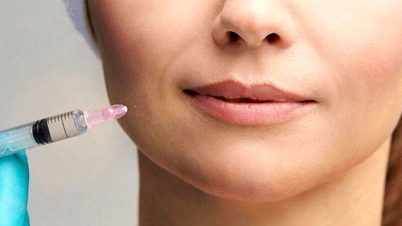 کدام پزشک در تهران بهترین تزریق چربی را انجام می‌دهد؟ راز جوانسازی پوست فاش شد!