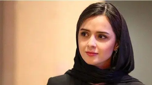 ترانه علیدوستی پس از یک سال پنهان‌کاری از بیماری نادر و وحشتناکش پرده برداشت!