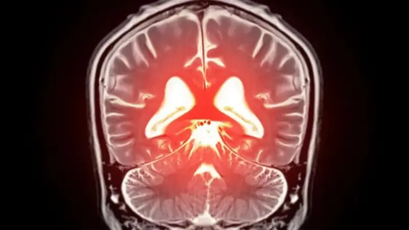 کشفی نوین: چگونه کنترل یک پروتئین کلیدی می‌تواند زوال عقل را متوقف کند؟