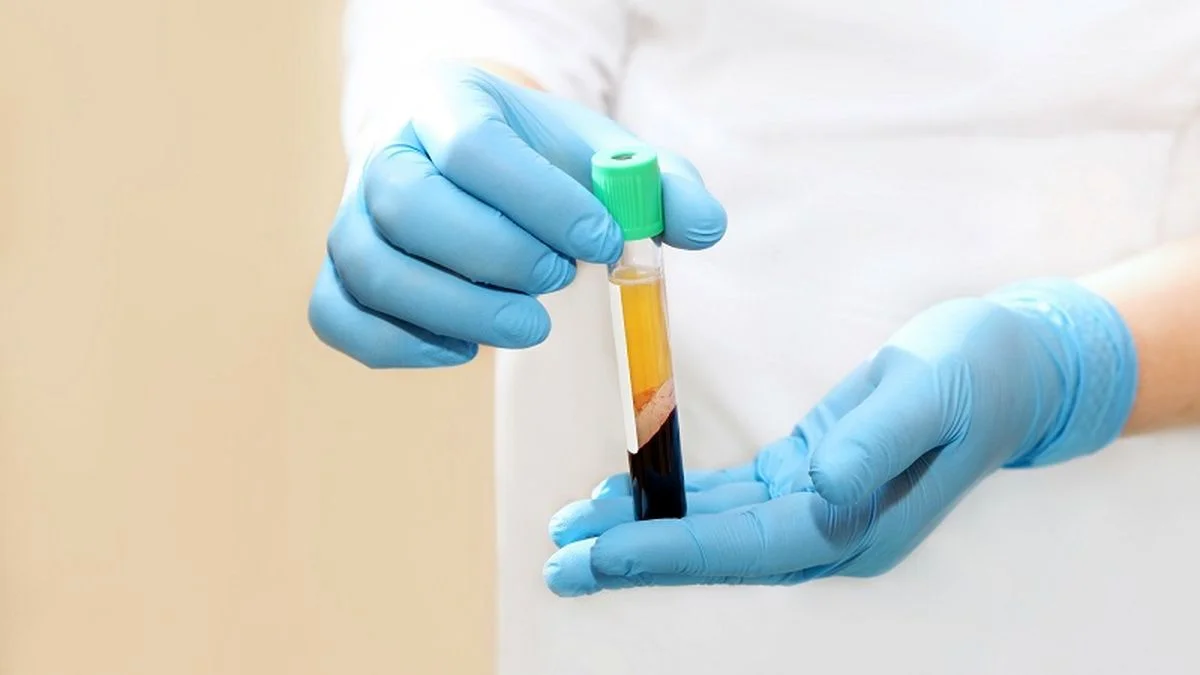 PRP یا داروهای سنتی؛ کدام درمان زخم معجزه می‌کند؟