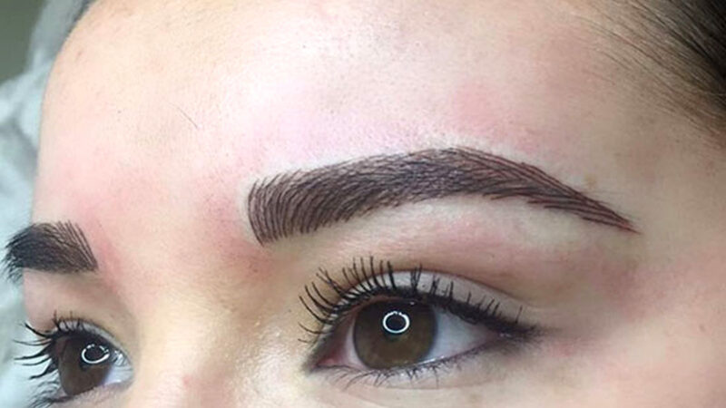 پاک کردن تاتو؛ روش‌هایی که شاید نمی‌دانستید چطور زندگی‌تان را تغییر می‌دهند!