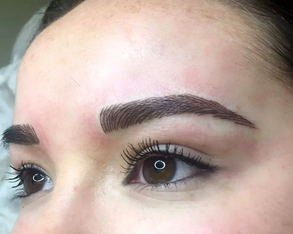 پاک کردن تاتو؛ روش‌هایی که شاید نمی‌دانستید چطور زندگی‌تان را تغییر می‌دهند!