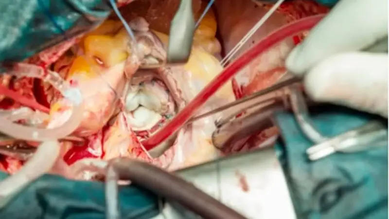 اعتراض شدید پزشکان به حقوق نازل؛ جراحی قلب باز نزدیک ۲ میلیارد تومان چرا؟